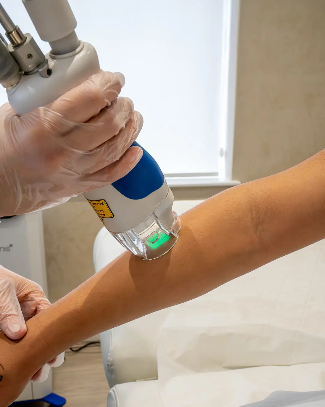 Smooth skin with professional laser hair removal in London