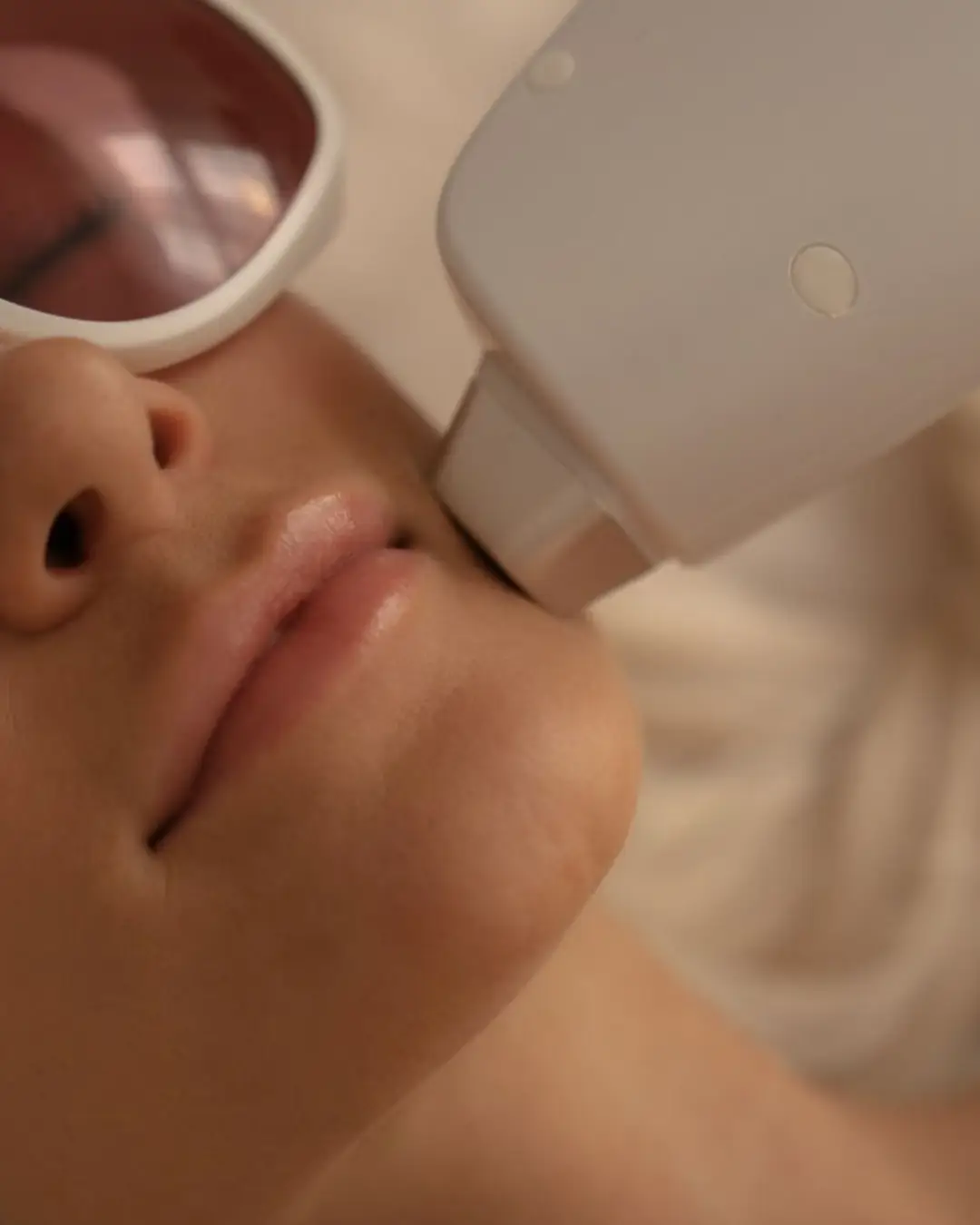 Splendor X laser hair removal machine at Pure Wax London Soho clinic